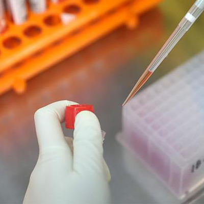Речной порог сертификата ISO IgG IgM Monkeypox набора теста инфекционного заболевания в 15 минутах